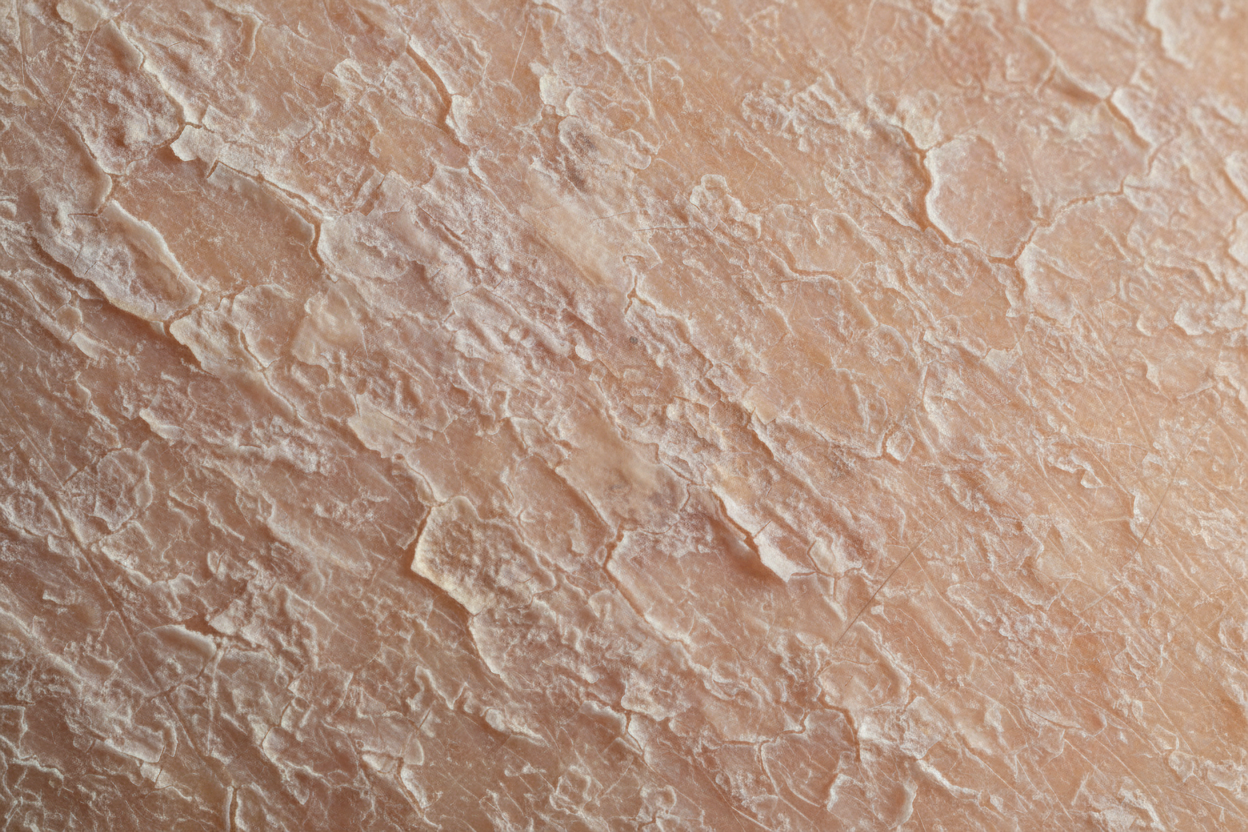 générer photo ultra réaliste d'une peau sèche 